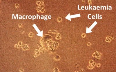University Research Looks at Antioxidants’ Potential Role in Cancer Therapy